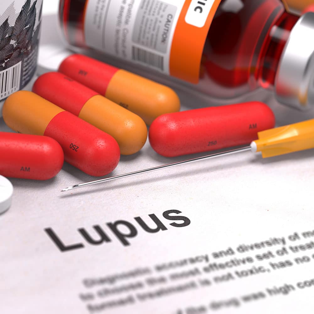 Researchers Explore Origins of Lupus, Find Reason for Condition’s Prevalence Among Women