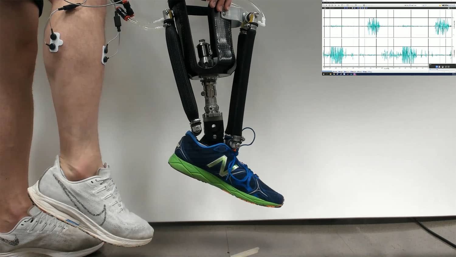 Robotic Prosthetic Ankles Improve ‘Natural’ Movement, Stability
